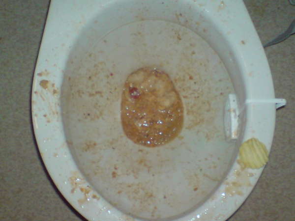 One night at the local chinese resturant vomit