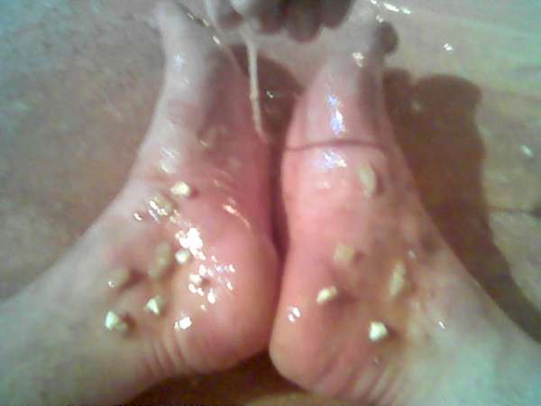 foot bath vomit