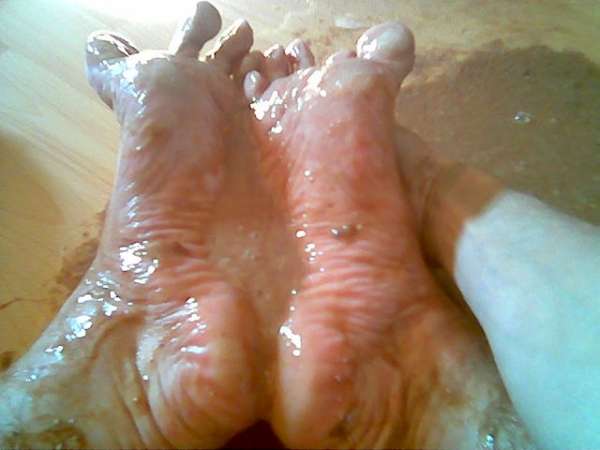 foot vomit vomit