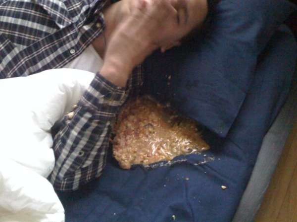 Guess what it is!! vomit