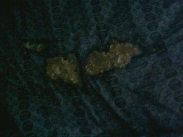 My Lover's Vomit vomit