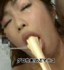 Yellow copious vomit vomit