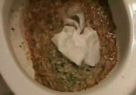 bulima aftermath2 vomit