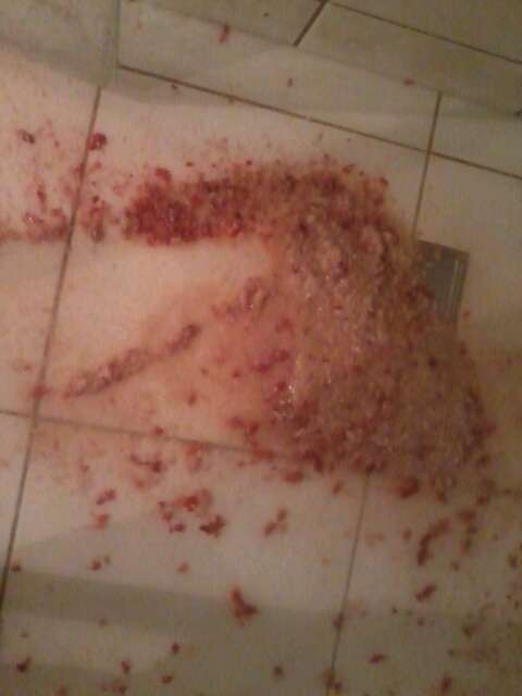 Fried Potato and Strawberries vomit