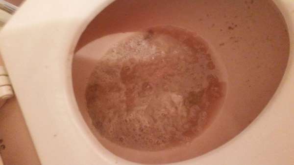 sick at nighi (2) vomit