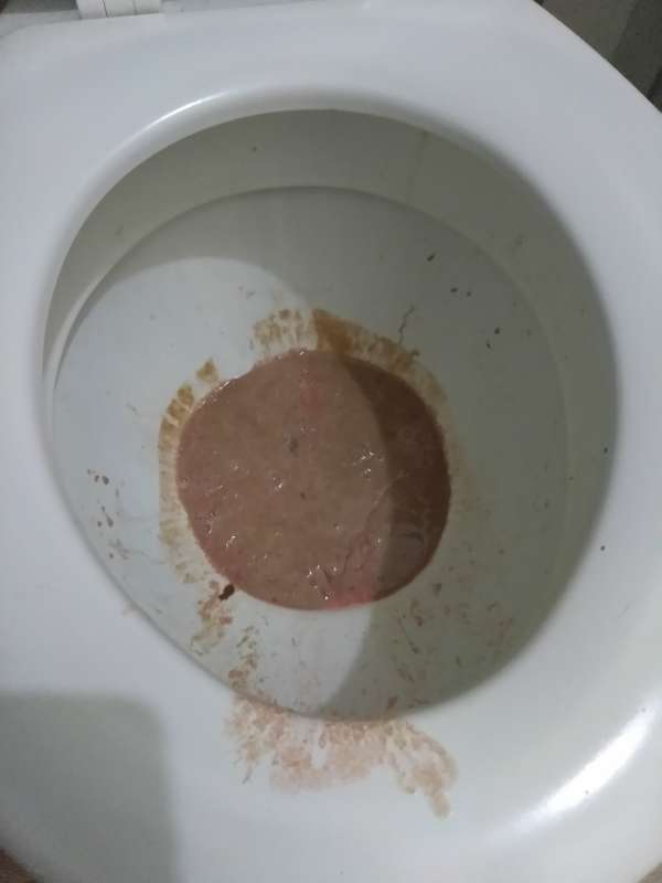 After dinner vomit