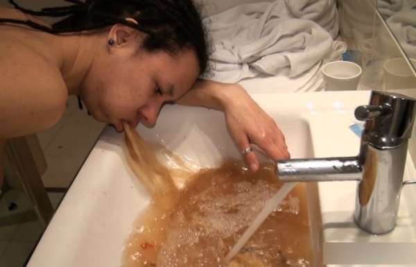 It came up on its own but it might not go down that way vomit