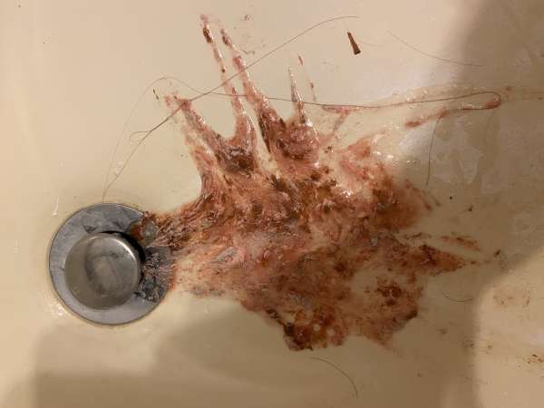 I think I’m dying vomit