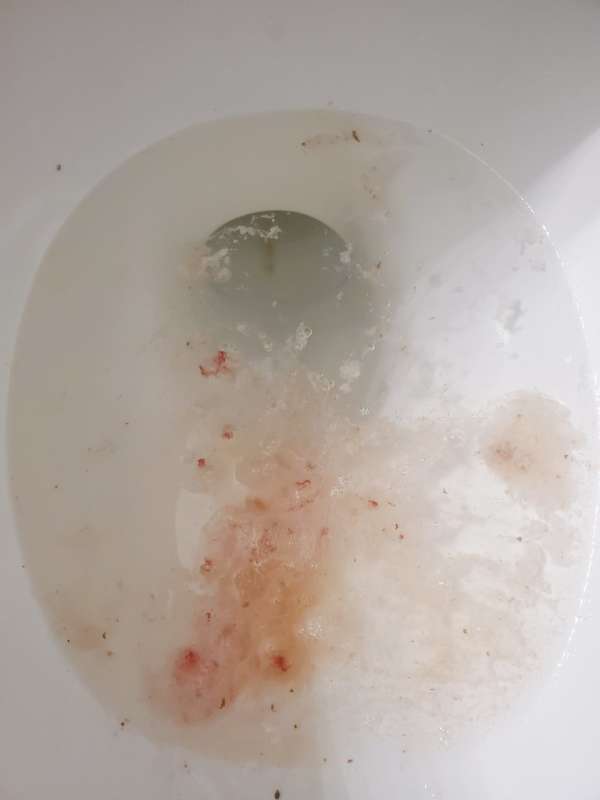 mostly empty stomach vomit