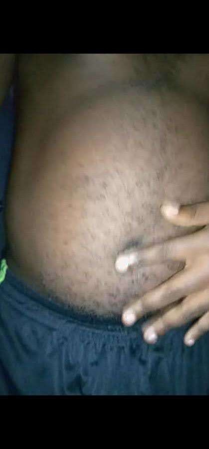 My belly will burst vomit