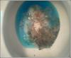 Blue loo puke vomit