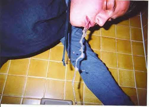 after funneling vodka vomit