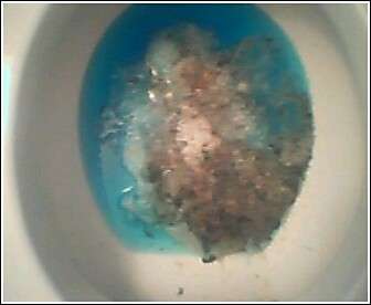 Blue loo puke vomit