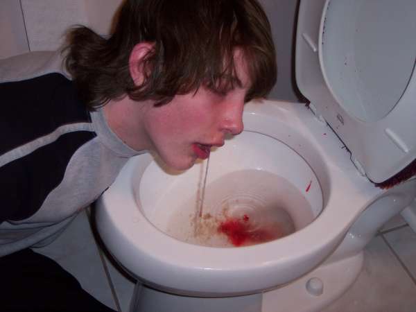 Bloody Nose and Jack vomit