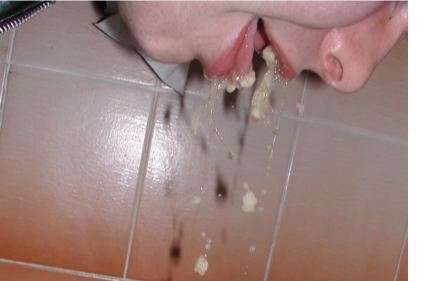 bitty vomit
