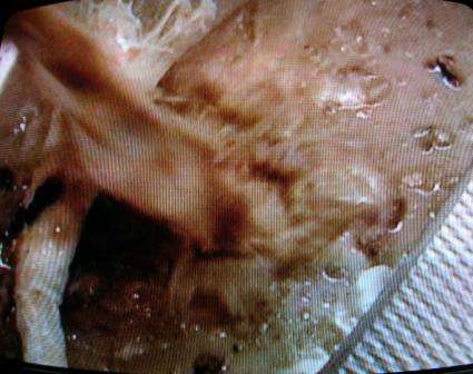 Cinnamon-bunParty vomit